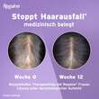 Regaine Frauen 20 mg / ml L&ouml;sung z.Anw.a.d.Kopfhaut - 5