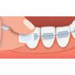 Gum Orthodontisches Wachs - 4