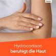 Hydrocortison-ratiopharm 0,5% Spray - 2