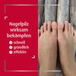 Canesten EXTRA Nagelset - 2