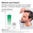 Alopexy 5% L&ouml;sung zur Anwendung auf der Haut - 7