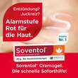 Soventol Hydrocortisonacetat 0,25% Creme - 2