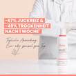Avene Xeracalm A.D Creme - 2