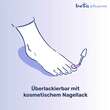 Amorolfin beta 50 mg / ml wirkstoffhalt.Nagellack - 5