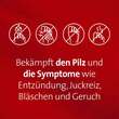 Mykosert Spray bei Haut- und Fu&szlig;pilz - 2