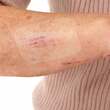 Leukomed T skin sensitive steril 8x10 cm - 3