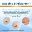 Endwarts Extra gegen Stielwarzen - 4