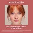 Isdin Fotoultra Redness Creme Lsf 50 - 8