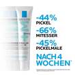Roche-Posay Effaclar Duo + M Creme - 4