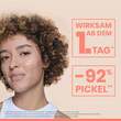 Avene Cleanance Comedomed Peeling Anti-Pickel Pflaster  - 3
