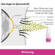 OCUVERS spray complete Augenspray mit Liposomen - 7