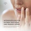 Widmer Remederm dry Skin Lippenbalsam - 4