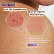 A-Derma Epitheliale Ultra Repair Creme - 5