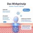 Acetocaustin Stielwarzen Entferner Stift - 4