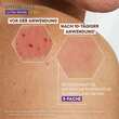 A-Derma Epitheliale Ultra Repair Creme Lsf 50 +  - 5