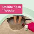 Myfungar Medizinisches Fu&szlig;bad Granulat - 6