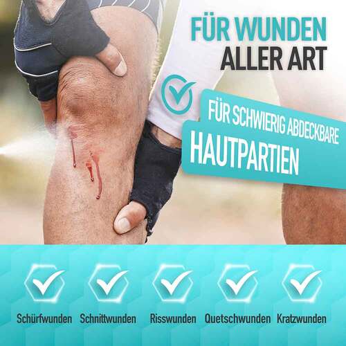 Flint Spr&uuml;hpflaster - 5