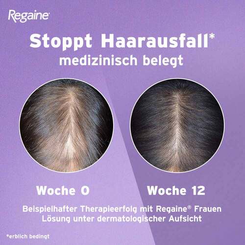 Regaine Frauen 20 mg / ml L&ouml;sung z.Anw.a.d.Kopfhaut - 5