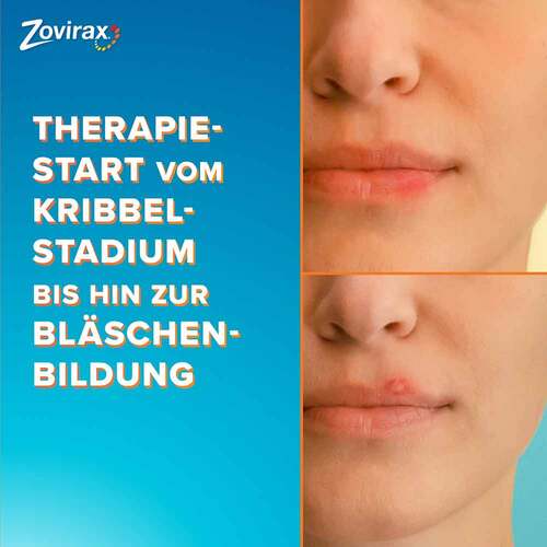 Zovirax Lippenherpes Creme - 6