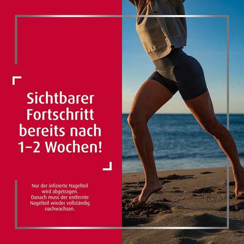 Canesten EXTRA Nagelset - 7