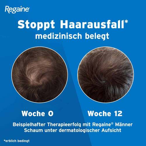 Regaine M&auml;nner Schaum 50 mg / g - 5