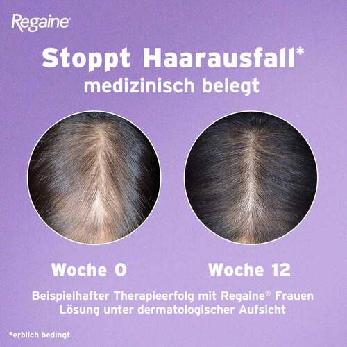 Regaine Frauen Schaum 50 mg / g - 5