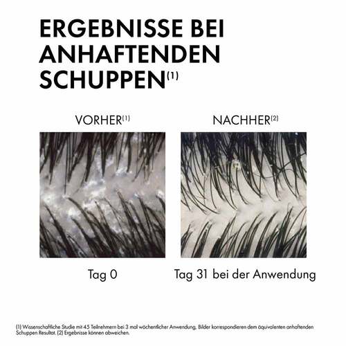 Vichy Dercos Anti-Schuppen Shampoo trock.Kopfhaut - 5