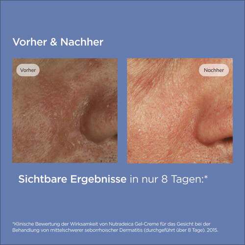 Isdin Nutradeica Gel-Creme Gesicht - 4