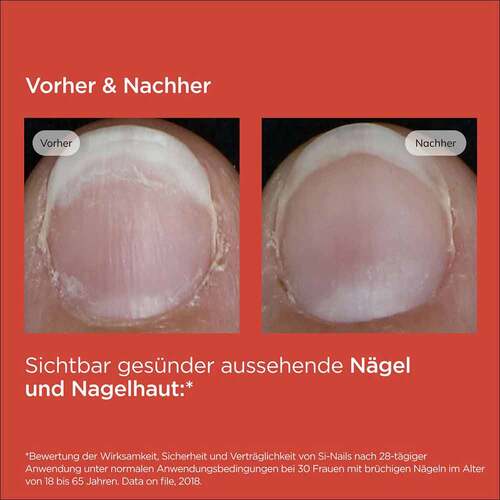 Isdin Si-Nails Nagelh&auml;rter Stift - 7