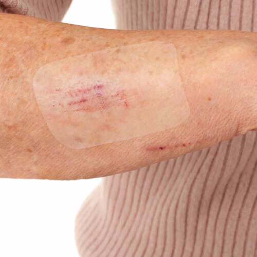 Leukomed T skin sensitive steril 8x10 cm - 3