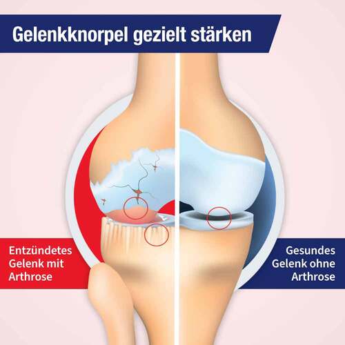 Gelencium arthro Mischung - 2