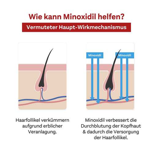 Minoxidil DoppelherzPhar.50mg / ml L&ouml;sung Anw.Haut Mann - 6