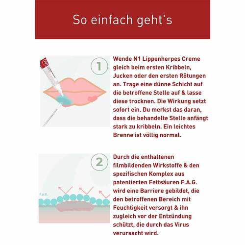 N1 Lippenherpes Creme - 3