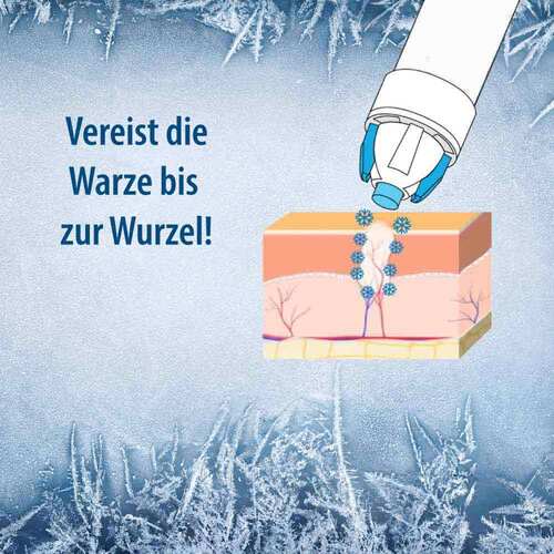 Evolsin Warzenvereiserspray - 4
