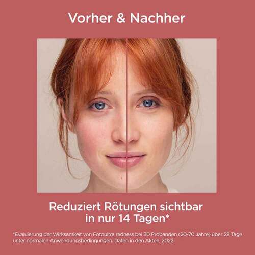 Isdin Fotoultra Redness Creme Lsf 50 - 8
