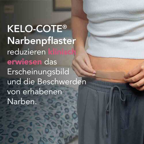 Kelo-Cote Silikon-Narbenpflaster Kaiserschnitt - 2