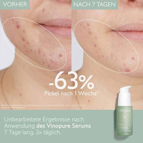 CAUDALIE Vinopure Springt Set 2023 - 2