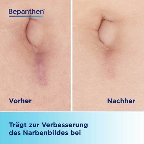 Bepancare Narben-Gel - 3