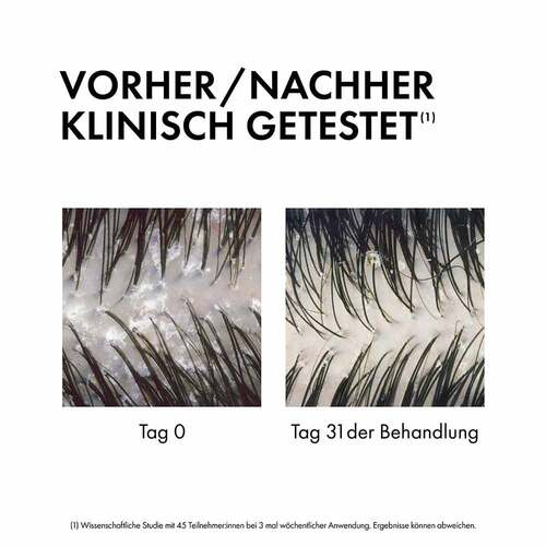 Vichy Dercos Anti-Schuppen 2in1 Shampoo Condition. - 5
