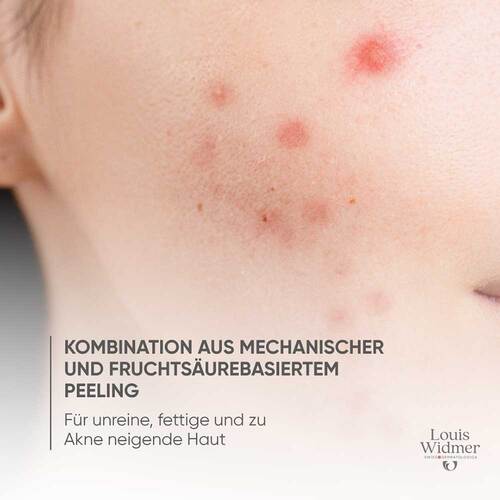 Widmer Skin Appeal Peeling ohne P. - 4