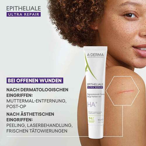A-Derma Epitheliale Ultra Repair Creme - 2