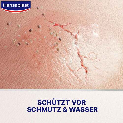 Hansaplast Zweite Haut Schutz Fl&uuml;ssig- Pflaster Konzentrat  - 3