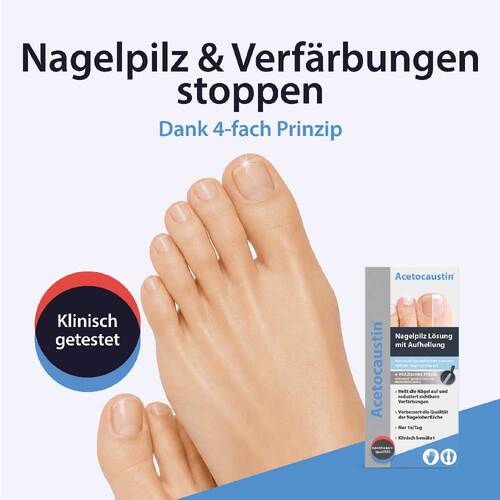 Acetocaustin Nagelpilz L&ouml;sung mit Aufhellung - 2
