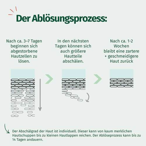 Allg&auml;uer Latschenkiefer Hornhaut Entf.Maske cremig Set - 6